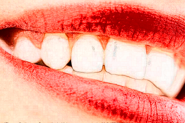 义乌傅氏口腔门诊部全瓷牙能用多久?全瓷牙的危害
