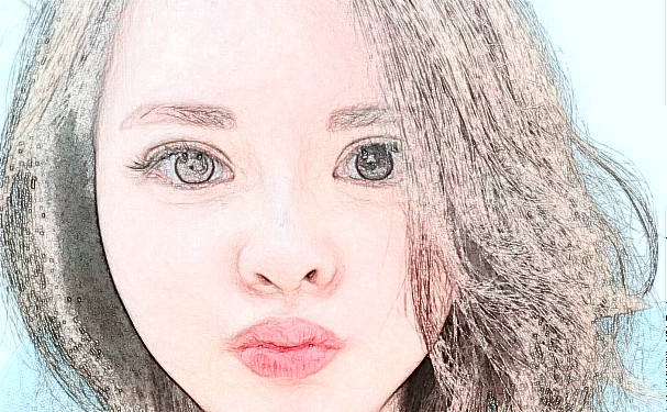 上海瑰丽医疗美容门诊部打玻尿酸术后三个月求美案例|技术亮点怎么样?需要多少钱