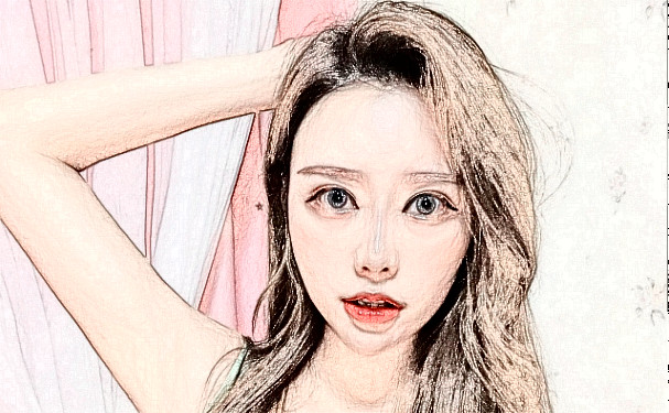 成都恒博天姿医疗美容门诊部玻尿酸填充全脸90天案例欣赏|技术测评怎么样?费用多少