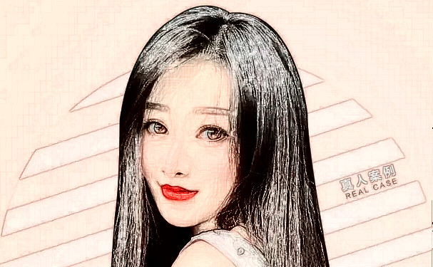 青岛市南区诺美德医学美容门诊部打玻尿酸技术等级怎么样?野生案例&价目一览表