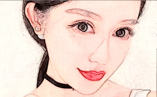 华中科技大学同济医学院医院玻尿酸填充全脸一年案例点评|技术测评怎么样?费用标准