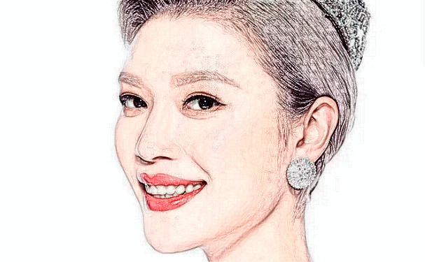 丽水黄君曼整形医院去颈纹技术怎么样?费用查询?半年亲测案例全解