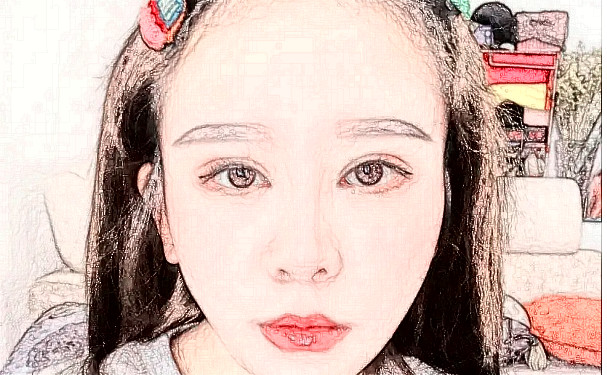 长沙丽臻医疗美容门诊激光除皱技术等级怎么样?术后90天案例&价格