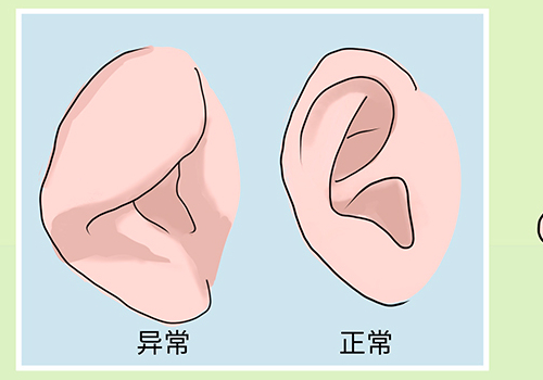 临海现代医院杯状耳矫正术后一年案例揭秘&价格查询?