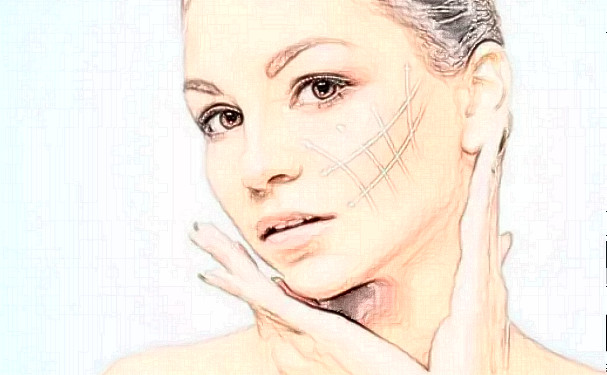 广州市白云区第一人民医院创伤整形外科耳朵矫正技术怎么样?150天术后案例展示|收费标准