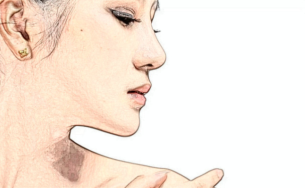 武汉市武昌医院整形科招风耳整形怎么样?多少钱?案例曝光&技术等级