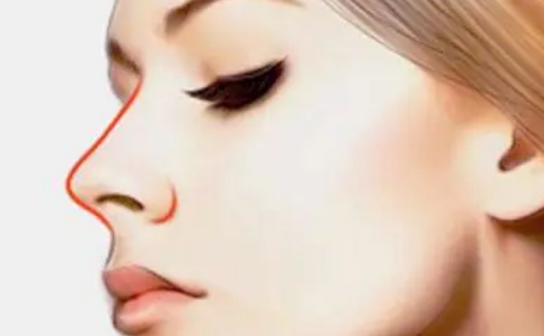 兰州亚韩整形医院整鼻子价格?技术亮点&术后半年案例欣赏