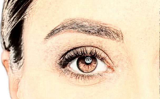 宁波壬美整形医院做双眼皮技术特点怎么样?120天经典案例