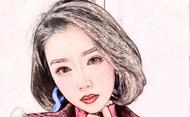 武汉洪山瑞丽诗医疗美容植发价格一览表?技术评价&术后三个月案例点评