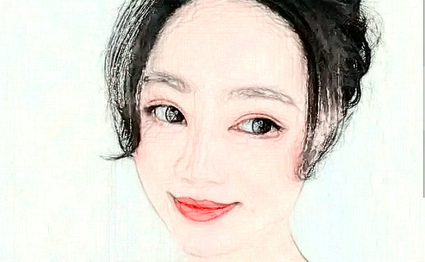 单县中心医院张彪激光美白祛斑技术特点怎么样?术后案例&疑问解答