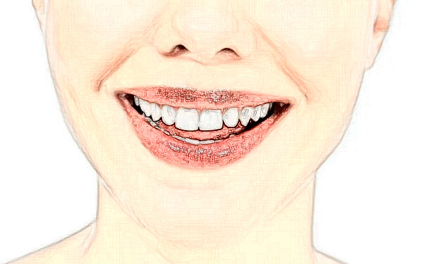 赤峰学院附属医院冯婧牙套正畸技术点评怎么样?恢复案例