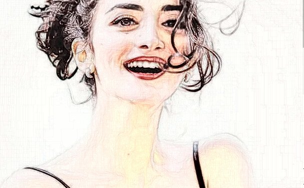 首都医科大学附属北京世纪坛医院尹宏宇牙齿拥挤矫正技术怎么样?多少钱?恢复案例