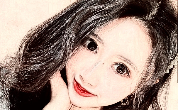 八大处整形医院解芳玻尿酸泪沟一年案例点评(效果怎么样?技术亮点)